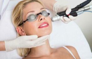 Laserverfahren zur Gesichtshautverjüngung
