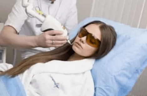 fraktionierte Laserverjüngung